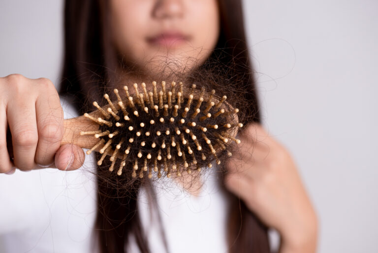 Causas da queda de cabelo